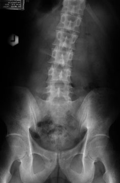 陳建良醫師|神經脊椎外科|我的文章|個人主頁|KingNet國家網路醫藥