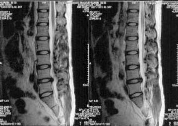陳建良醫師|神經脊椎外科|我的文章|個人主頁|KingNet國家網路醫藥